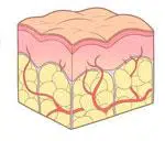 shéma de la cellulite