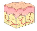 shéma de la cellulite