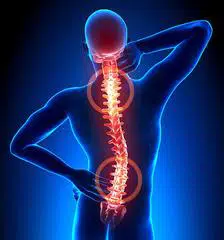 pincement discal c5 c6 douleurs